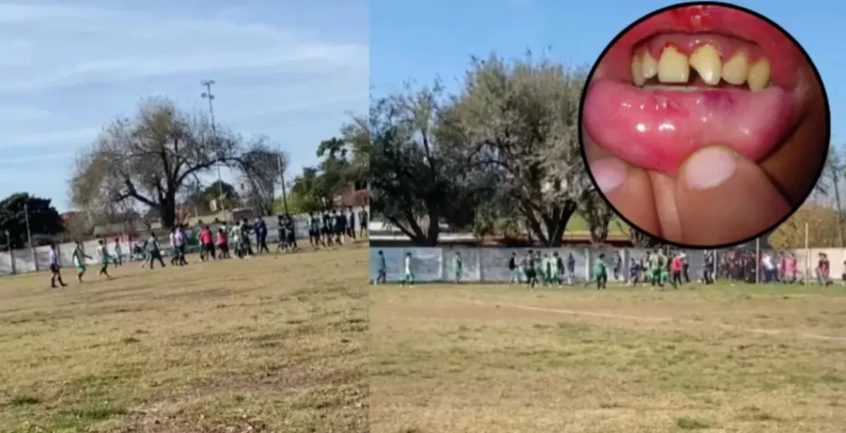 Otra vez violencia entre dos clubes de la Liga Sanlorencina: Sargento Cabral y PSM Fútbol terminaron a las trompadas en el partido de reserva