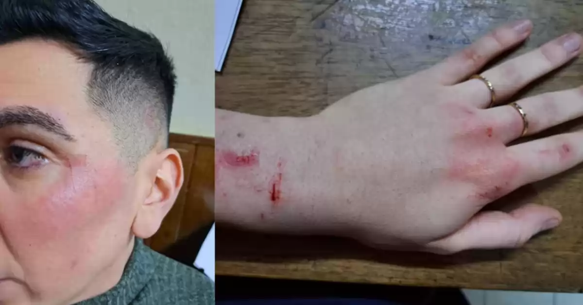 Un joven fue agredido por un patovica en un boliche de Capitán Bermúdez