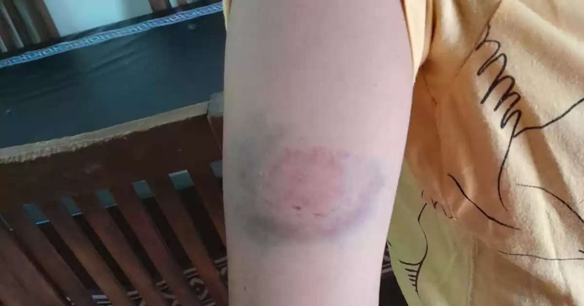 Violencia de género en Beltrán: agarró del cuello y le mordió el brazo a su pareja