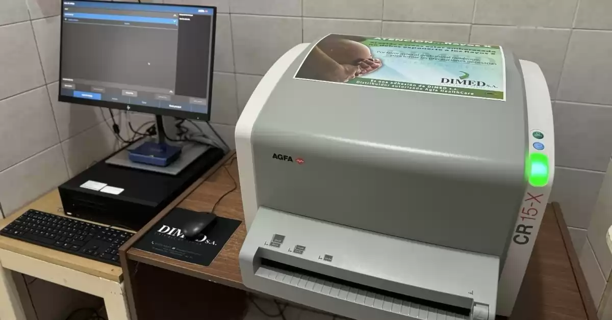 Incorporan tecnología para placas radiográficas en 40 hospitales públicos de Santa Fe