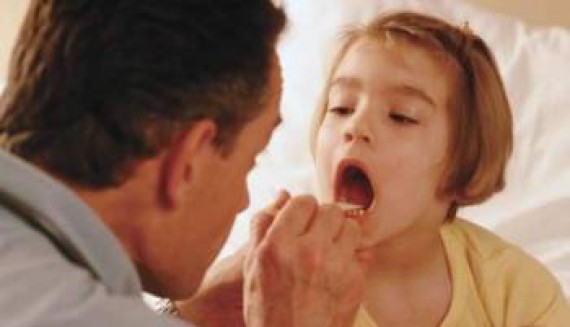 Niños con anginas recurrentes