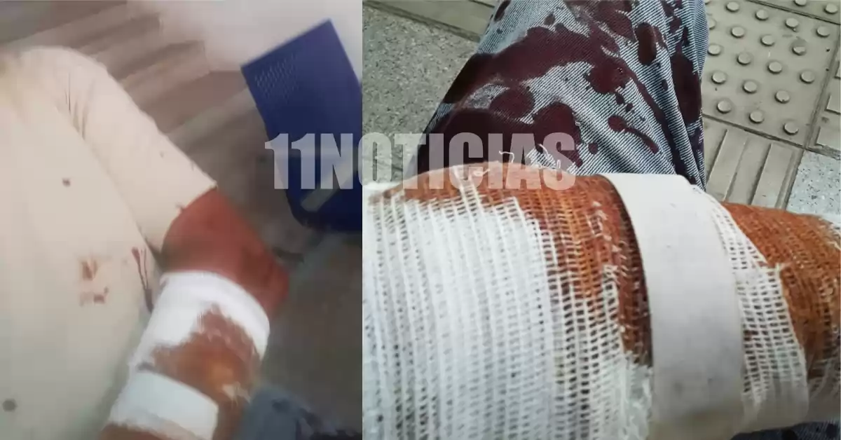 Hirieron a un camionero con una tijera de podar en el puerto de Bunge