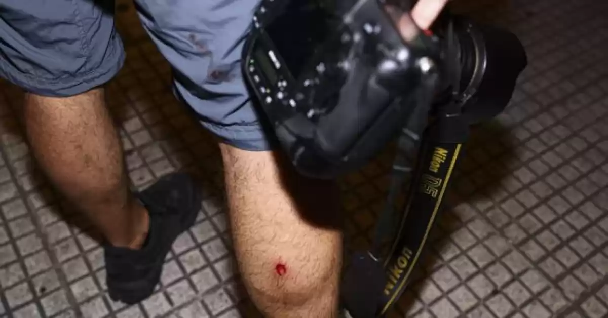 Trabajadores de prensa resultaron heridos por balas de goma durante la represión en Congreso