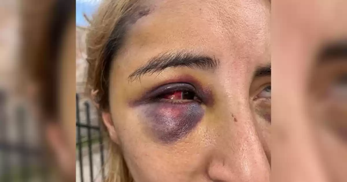 San Lorenzo: La golpeó hasta creer que estaba muerta y cambiarán la carátula a lesiones leves