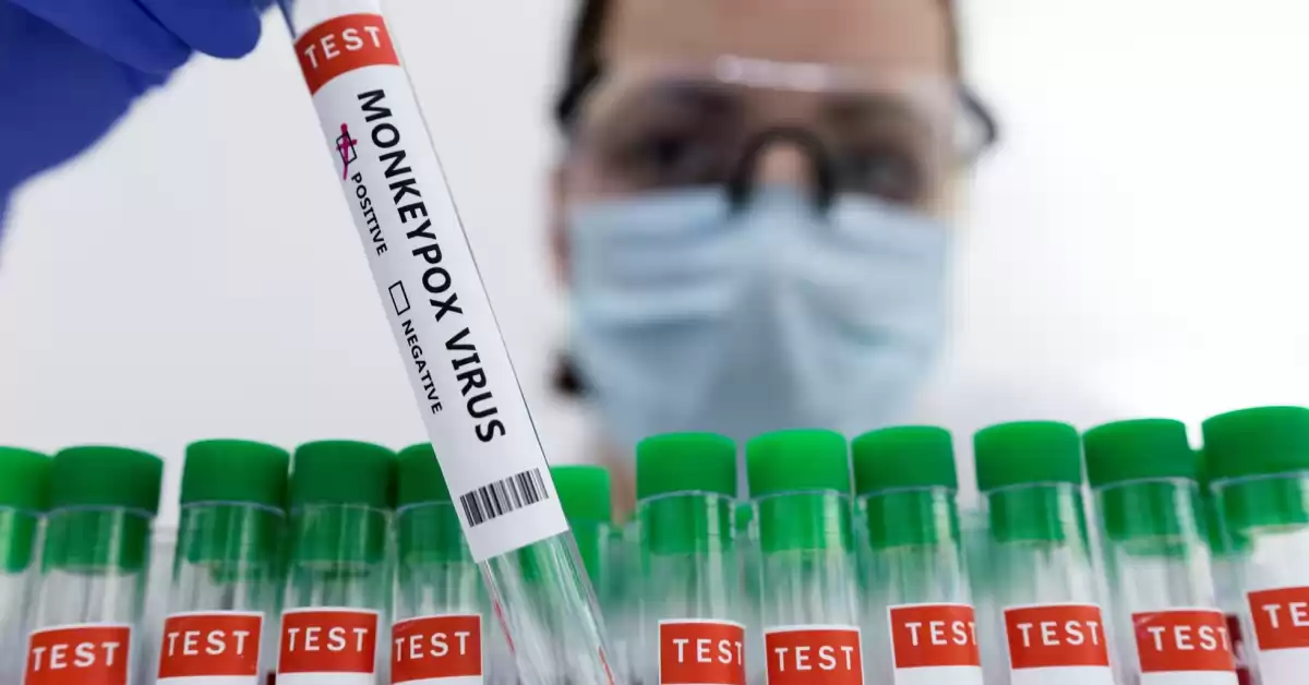 Europa roza los 20.000 casos de viruela del mono