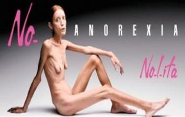 Muere la modelo francesa que protagonizó la campaña en contra de la anorexia.