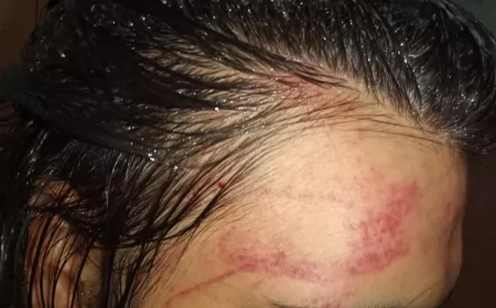 Beltrán: golpearon en patota a una adolescente trans hasta desmayarla