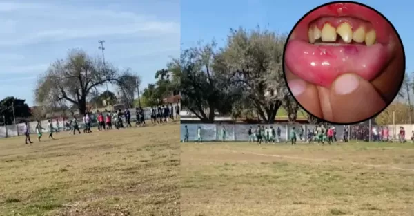 Otra vez violencia entre dos clubes de la Liga Sanlorencina: Sargento Cabral y PSM Fútbol terminaron a las trompadas en el partido de reserva