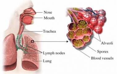 Aspergilosis pulmonar ¿Qué es y a quiénes afecta?