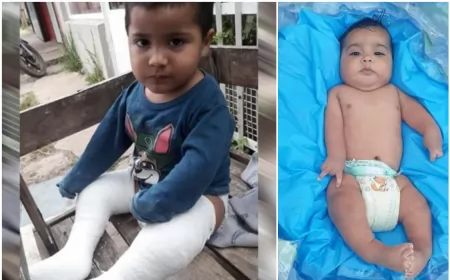 Rifa a beneficio de Keitan, el niño sanlorencino que sufre Artrogriposis, deformidad en brazos y piernas