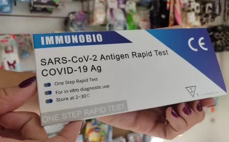 El test de detención rápida de Covid-19 llegó a las farmacias de San Lorenzo ¿Cuánto cuesta?