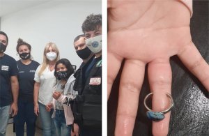 Bomberos cortaron un anillo que oprimía el dedo de una niña