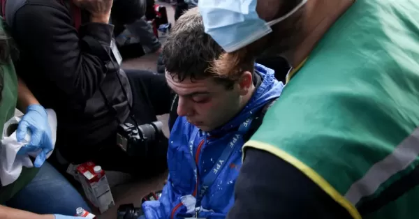 El fotógrafo que había sido amedrentado por Santiago Caputo fue brutalmente reprimido en la Plaza del Congreso