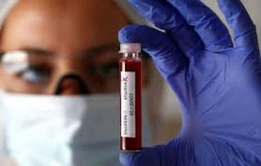 Llegaron los reactivos para hacer 31 mil pruebas de coronavirus y se distribuirán en las provincias