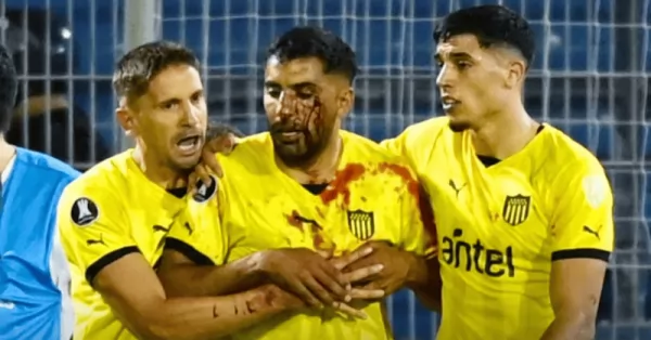 Condenaron al hincha de Rosario Central que arrojó un piedrazo a un jugador de Peñarol  