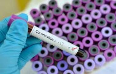 Santa Fe confirma 8 nuevos casos de coronavirus, uno es de San Lorenzo